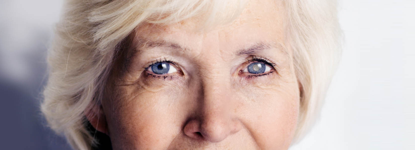 Cataract Surgery in Waite Park